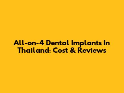 All-on-4 Dental Implants In Thailand: Cost & Reviews