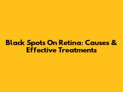 Black Spots On Retina: Causes & Effective Treatments