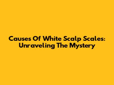 Causes Of White Scalp Scales: Unraveling The Mystery