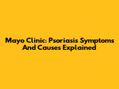 Mayo Clinic: Psoriasis Symptoms And Causes Explained