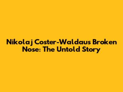 Nikolaj Coster-Waldau's Broken Nose: The Untold Story