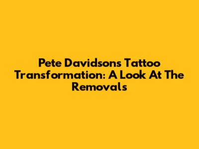 Pete Davidson's Tattoo Transformation: A Look At The Removals