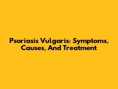 Psoriasis Vulgaris: Symptoms, Causes, And Treatment