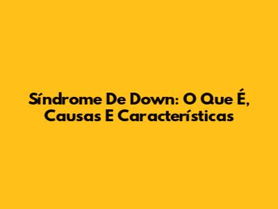Síndrome De Down: O Que É, Causas E Características