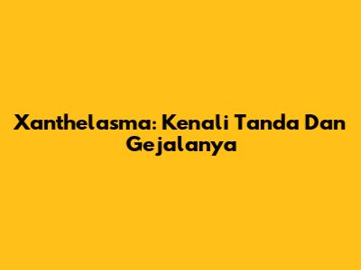 Xanthelasma: Kenali Tanda Dan Gejalanya